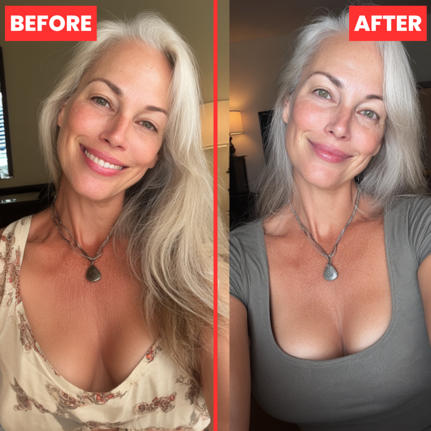 LustraLift® Natural Patches