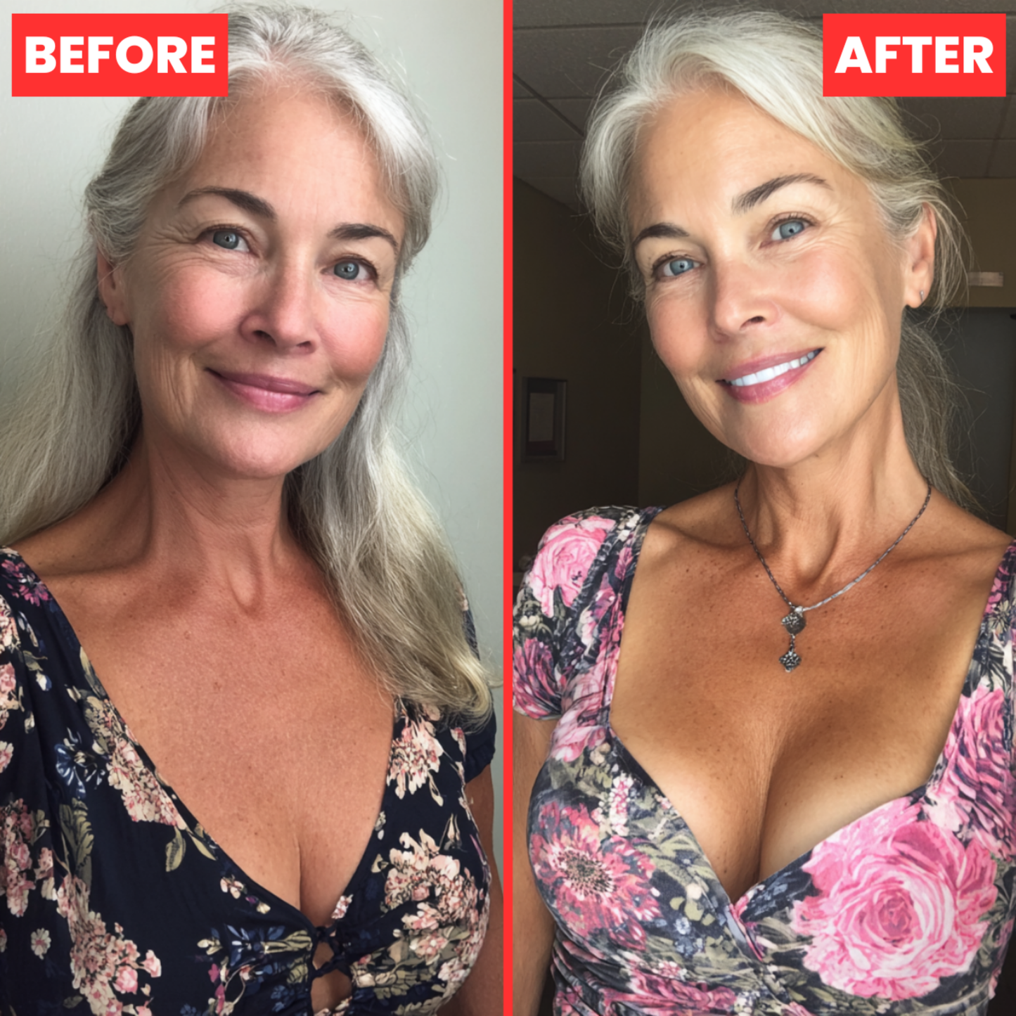 LustraLift® Natural Patches