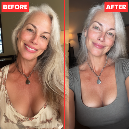 LustraLift® Natural Patches